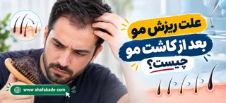علت ریزش مو بعد از کاشت مو چیست؟